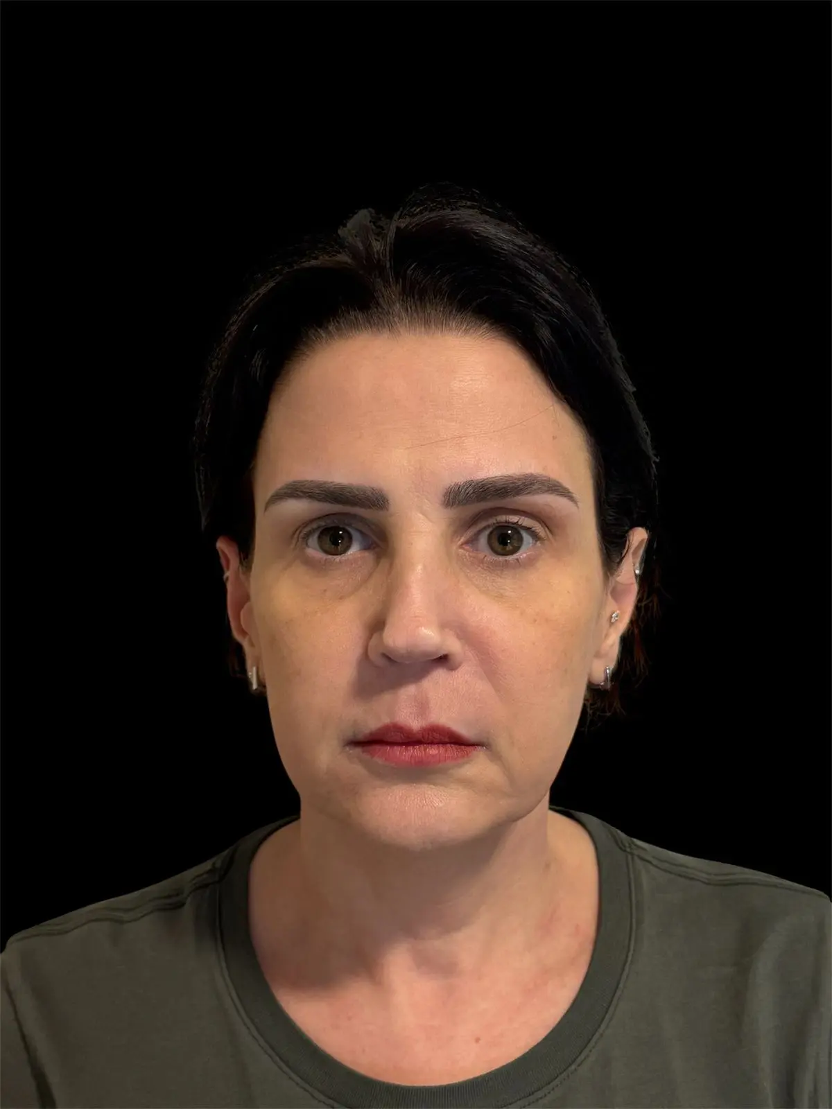 Depois do tratamento